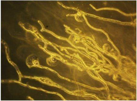 Drug delivery method can improve fungal infection treatment